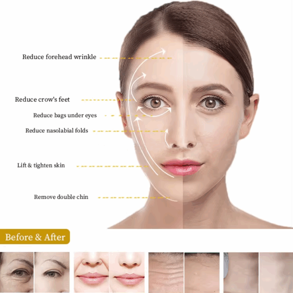 Collagen regeneration beauty salon special instrument V face face lifting and tightening 7D beauty artifact