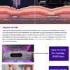 Desktop ultrasound hifu7D poly pull lifting facial beauty knife, private area care, firming knife, anti-aging cannon beauty